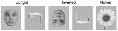 Sluggishness of Early-Stage Face Processing (N170) Is Correlated with Negative and General Psychiatric Symptoms in Schizophrenia